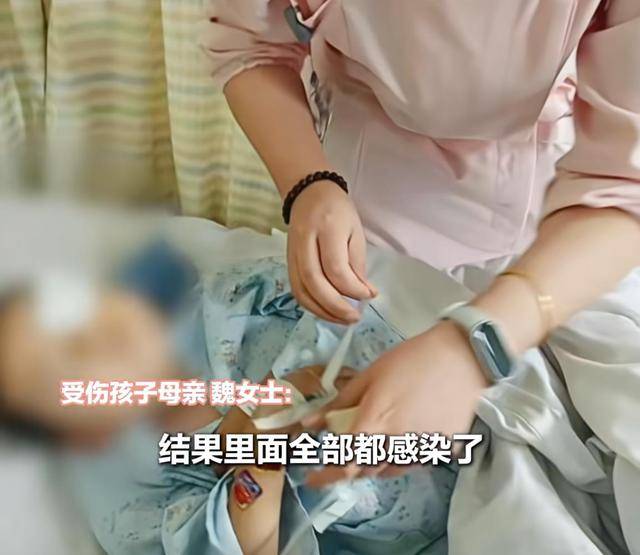 皇冠信用网出租代理_江西一5岁男孩在幼儿园被戳伤致左眼失明皇冠信用网出租代理，家长称老师用猪油涂抹试图消肿