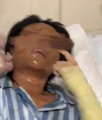 怎么开通皇冠信用網口_女主播称遭伪装快递包裹炸伤怎么开通皇冠信用網口，湖南警方通报