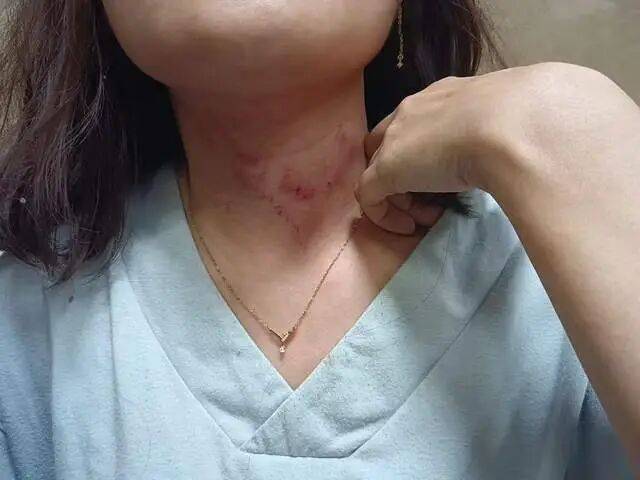 皇冠信用网平台出租
_一男子凌晨听到两声呼救皇冠信用网平台出租
，循声发现一女子在奔驰车外被白衣男勒昏！受害者：是受朋友之托借钱给白衣男，凌晨被骗至偏僻处遭非礼！